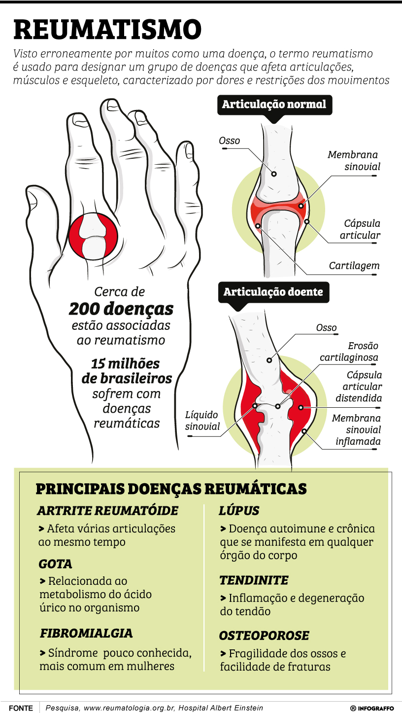 Infográfico do Dia