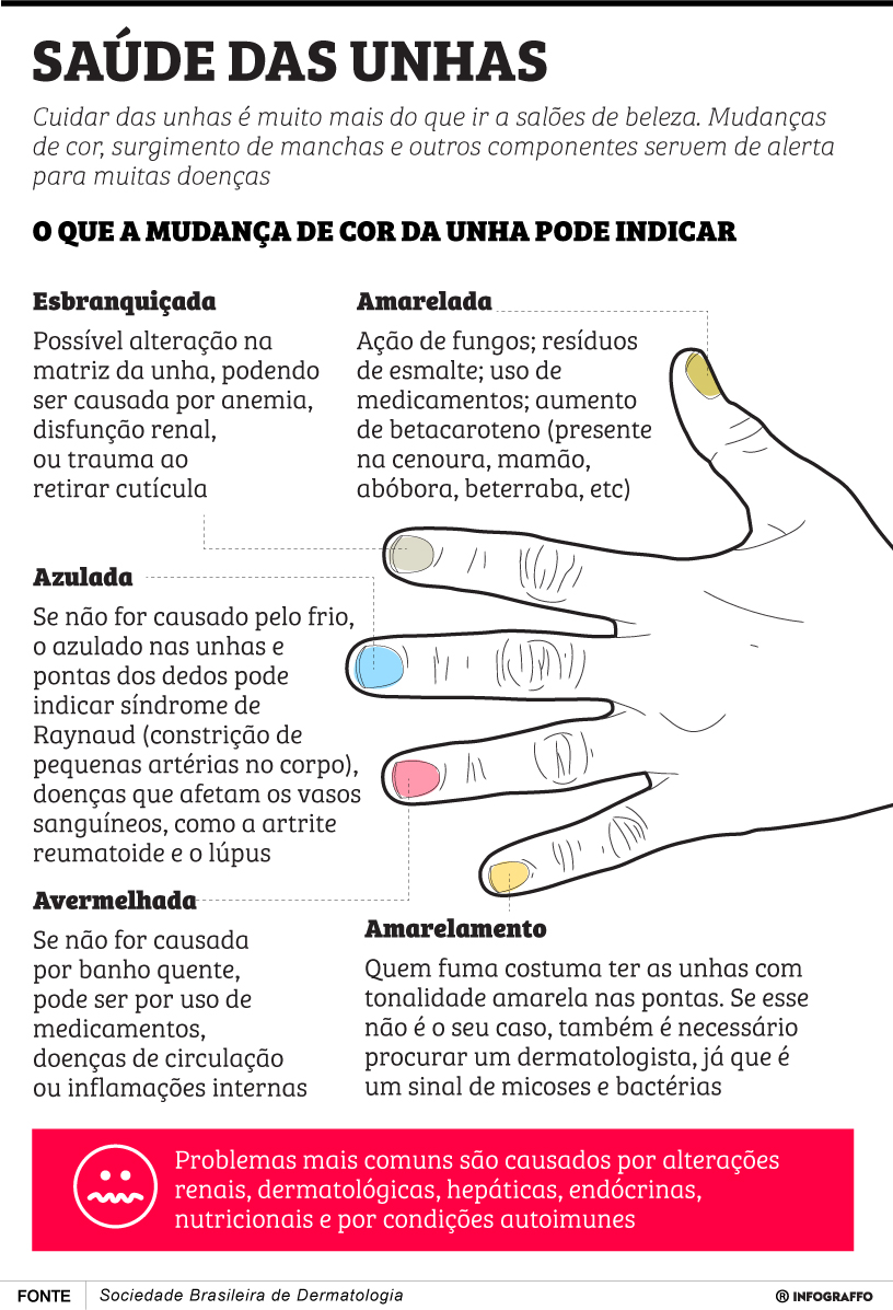 Infográfico do Dia